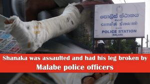 shanaka was assaulted and had his leg broken by Malabe police officers